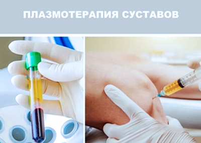 Плазмолифтинг